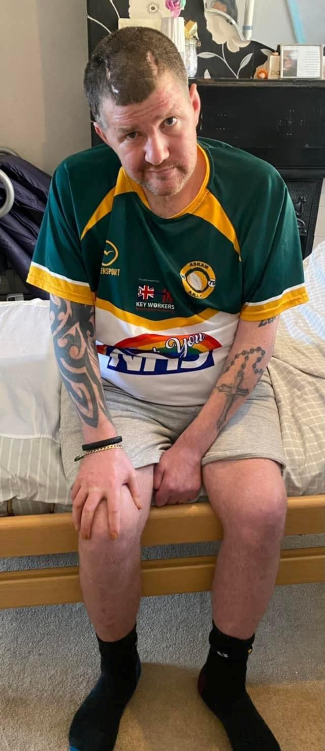 These shocking images show the aftermath of a father who suffered three terrifying strokes - and had parts of his skulls removed. See SWNS story SWLEskull;  Neil Jones, 39, had parts of his skull removed after suffering a life-changing haemorrhagic stroke in April 2021 and then two more after which meant that the left side of his body is now paralysed and he was in a coma until June.  Mr Jones, from Cumbria, was previously praised by police in 2018 for his bravery as he chased down and apprehended a man who was committing a sexual assault. (SWNS)