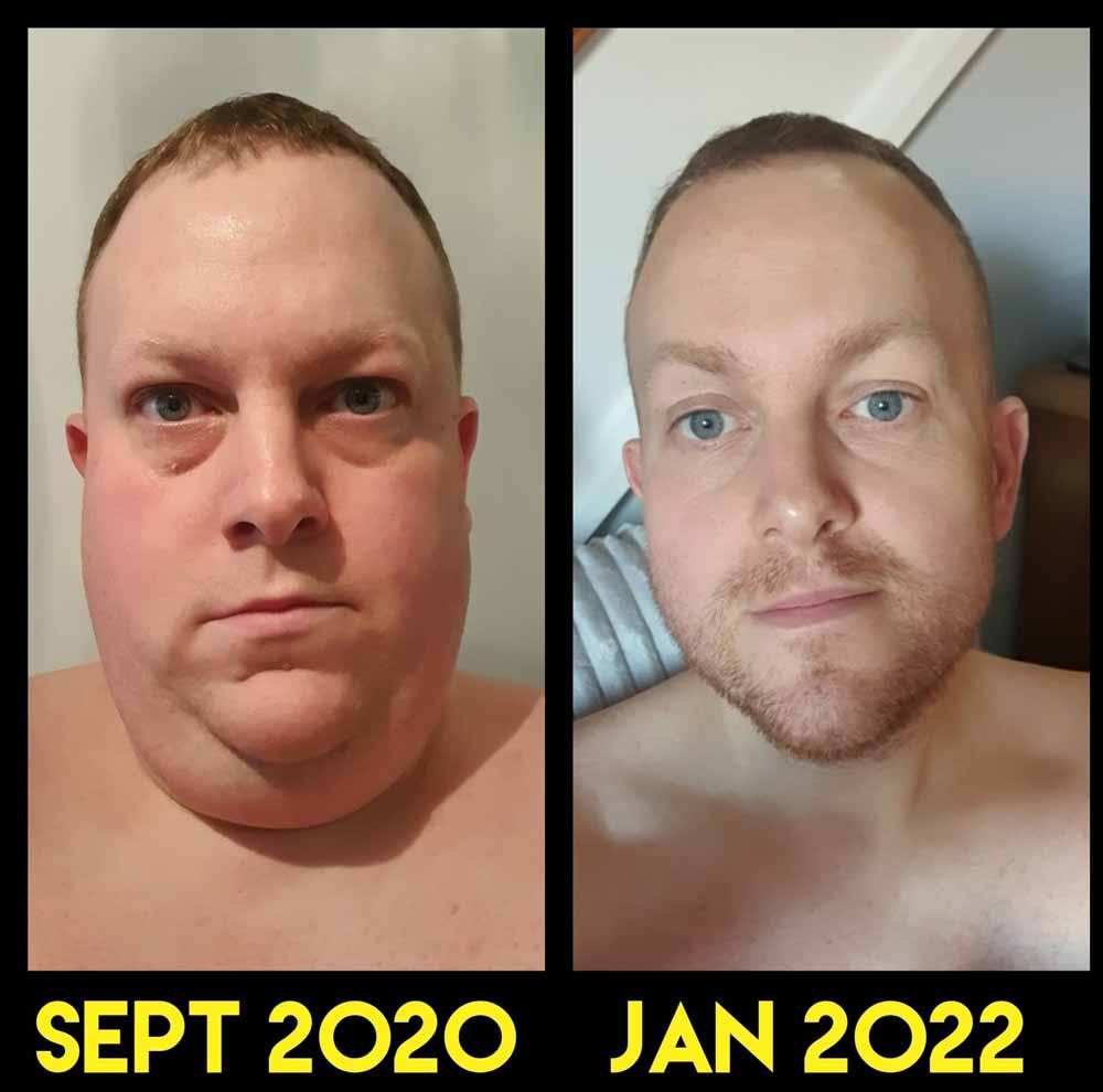 Richard before and after losing 8st 10lbs (Collect/PA Real Life).