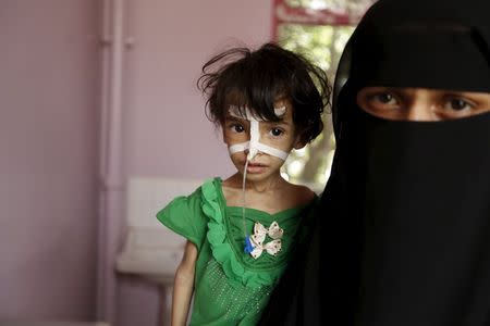A woman holds her malnourished daughter at a hospital in Yemen's capital Sanaa July 28, 2015. The war in Yemen has killed more than 3,500 people. REUTERS/Khaled Abdullah
