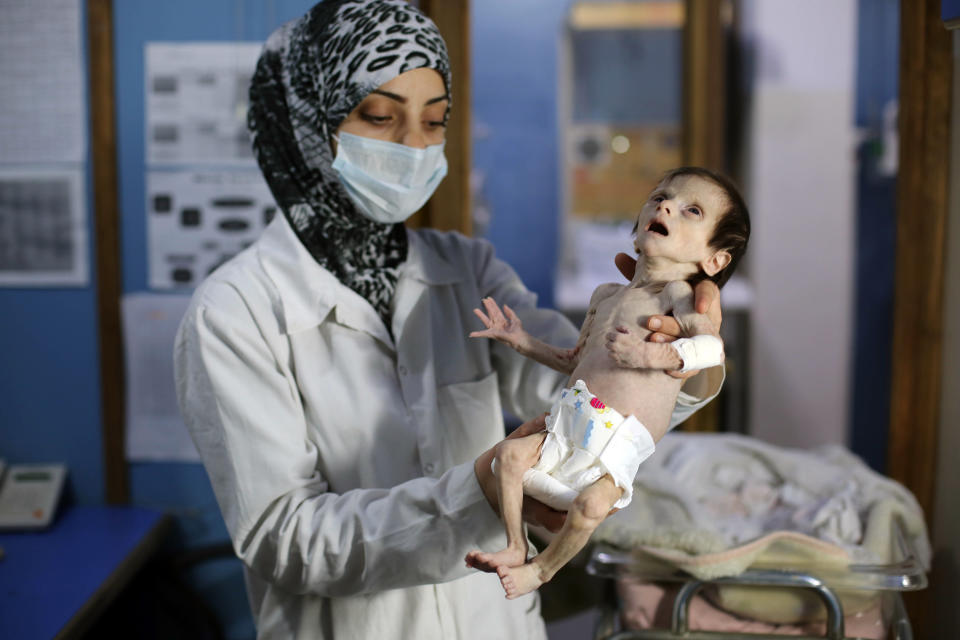 One of the final photos of 1-month-old&nbsp;Sahar Dofdaa, taken Oct. 21. (Photo: AMER ALMOHIBANY via Getty Images)