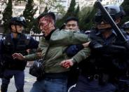 An unidentified injured man is escorted by riot police at Mong Kok in Hong Kong, February 9, 2016.ÊRiot police used batons and pepper spray early to quell fights after authorities tried to move illegal street vendors from a working-class Hong Kong district, the worst street clashes since pro-democracy protests in late 2014. REUTERS/Bobby Yip/File photo