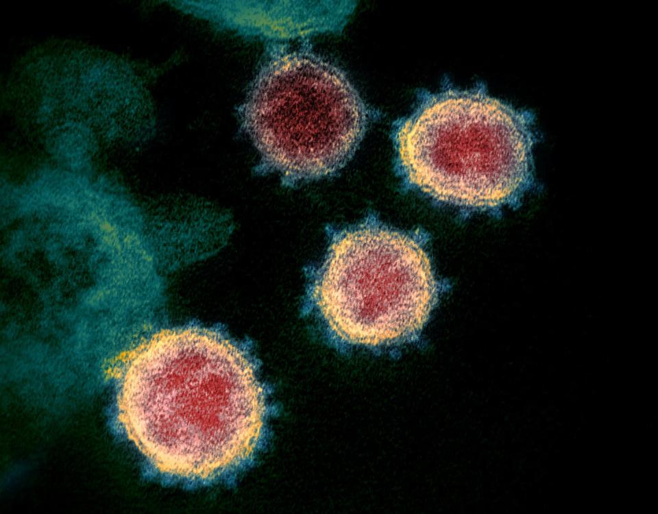 An electron microscope scan of the coronavirus