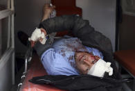 <p>An injured man looks out from an ambulance after a suicide attack in Kabul, Afghanistan, Saturday, Jan. 27, 2018. (Photo: Rahmat Gul/AP) </p>