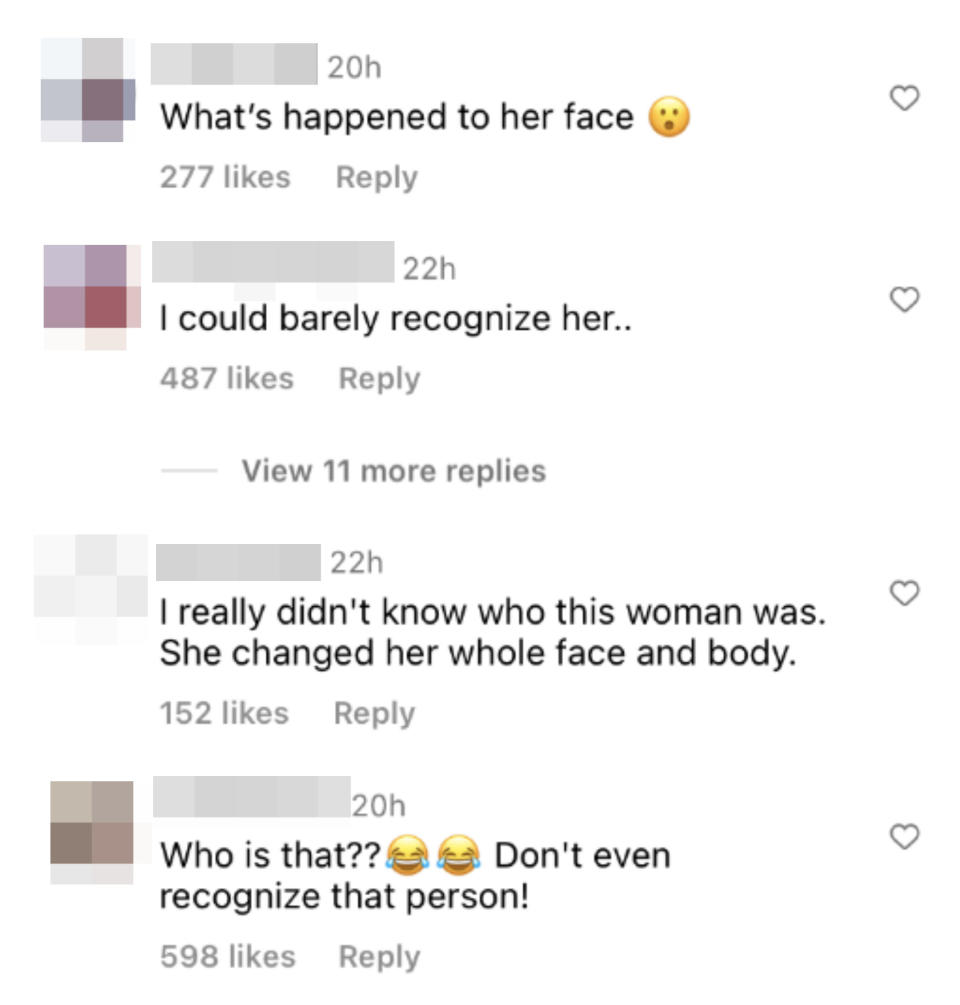 Screenshot of comments saying they don't recognize her and what happened to her face