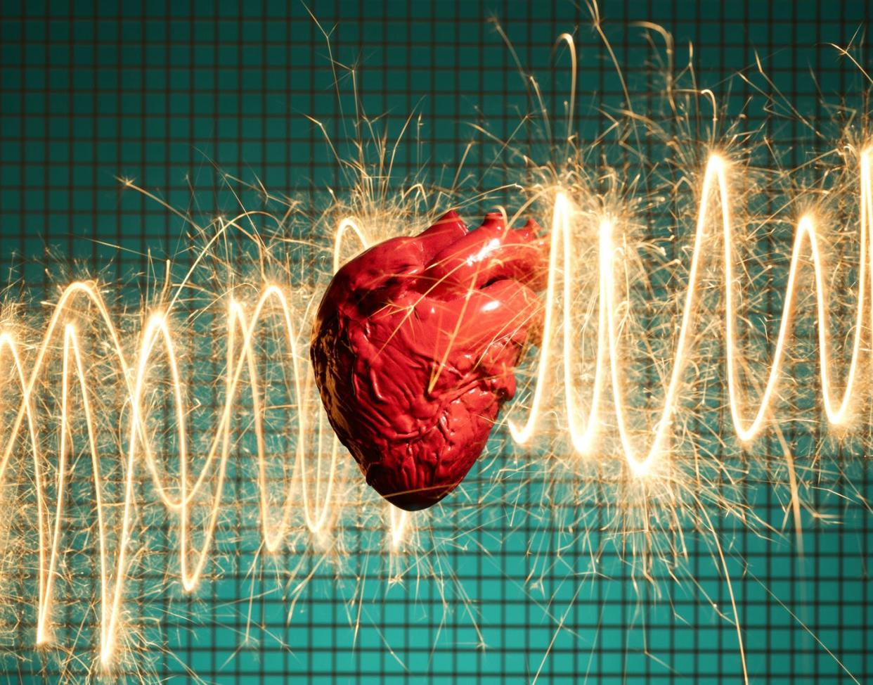 <span class="caption">Cardiovascular disease is the leading source of death worldwide.</span> <span class="attribution"><a class="link " href="https://www.gettyimages.com/detail/photo/human-heart-and-electrical-energy-royalty-free-image/921293970?adppopup=true" rel="nofollow noopener" target="_blank" data-ylk="slk:PM Images / Getty Images;elm:context_link;itc:0;sec:content-canvas">PM Images / Getty Images</a></span>