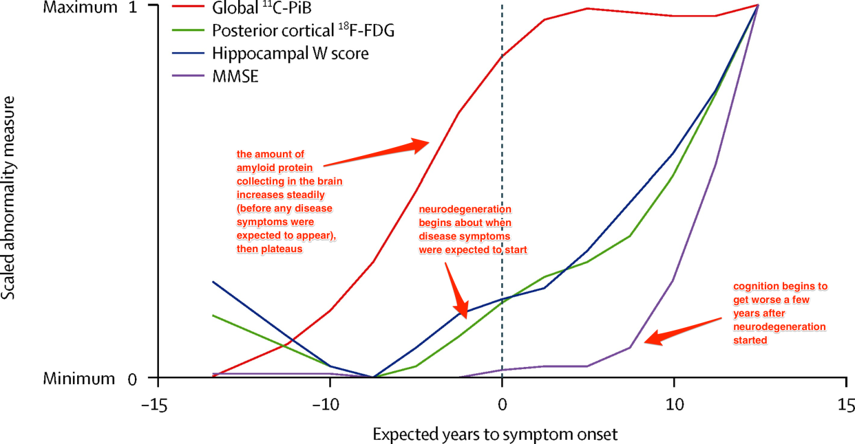 alz_progression_graph