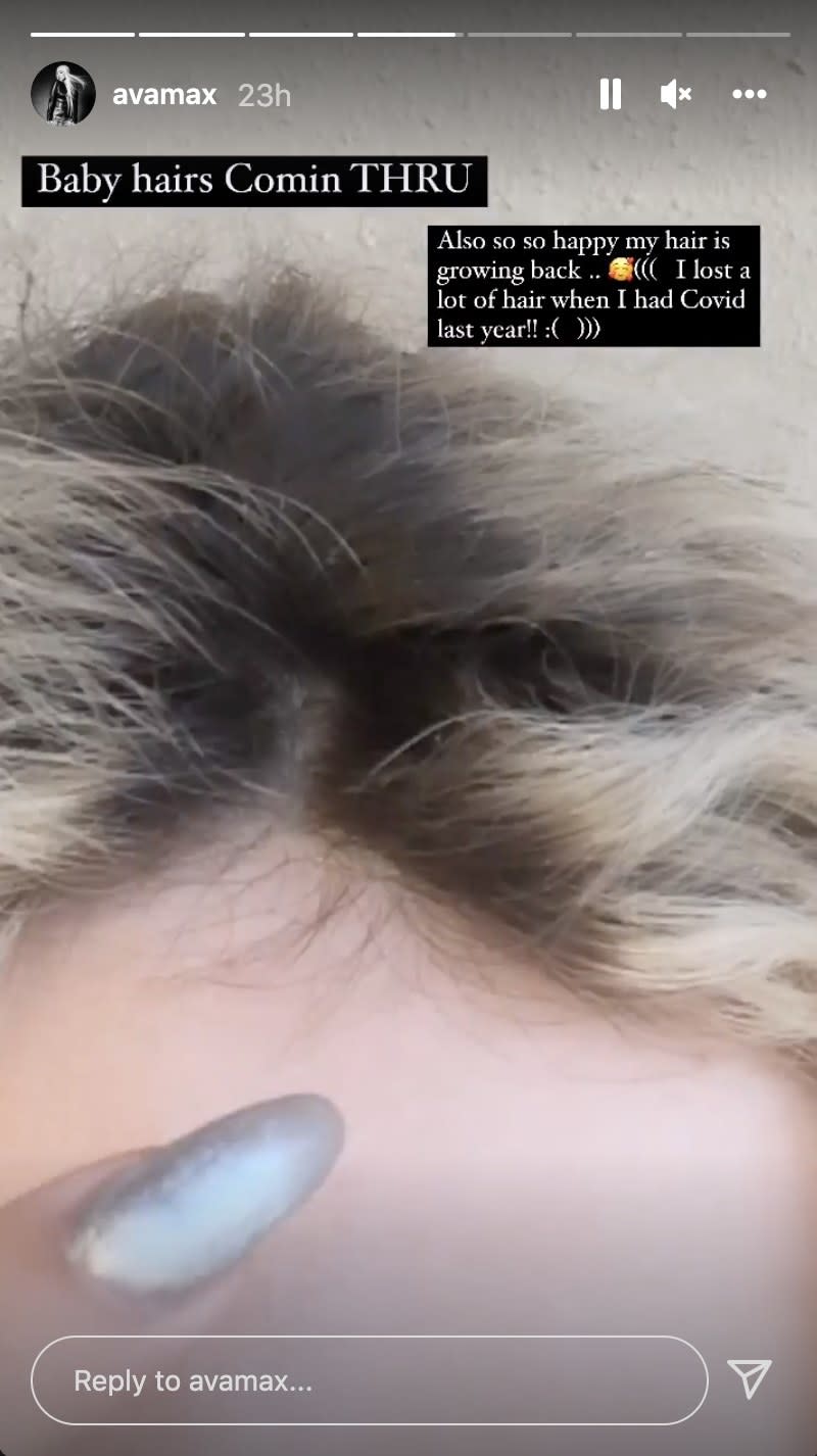 A close up of Ava's hair line where small baby hairs can be seen