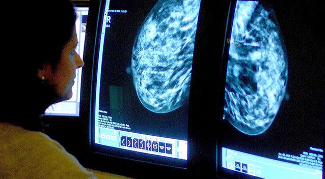 Consultant examining a mammogram. Source: Rui Vieira/PA Wire