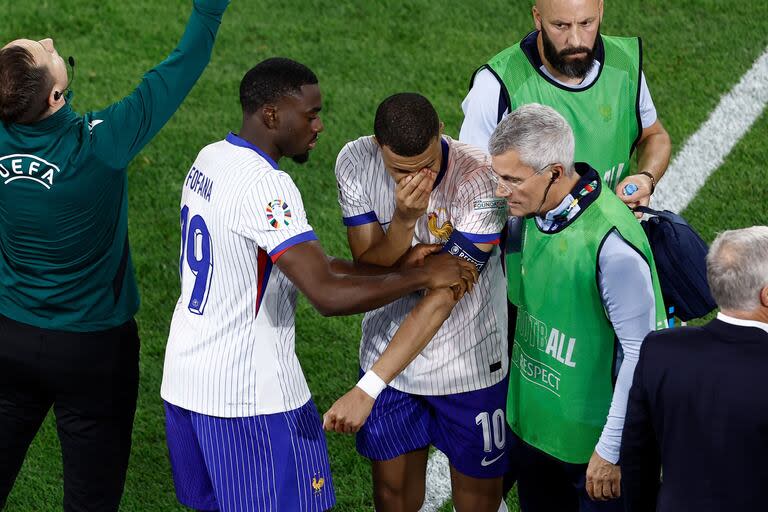 Mbappé debió retirarse del campo de juego por el duro golpe en su nariz