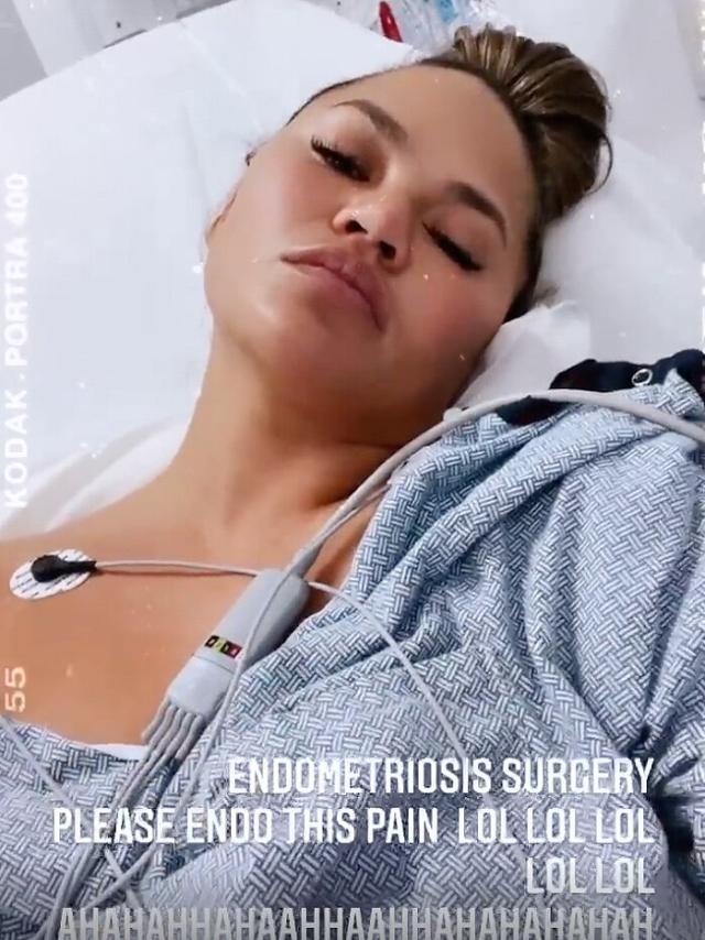 Chrissy Teigen Poses Topless on Instagram After Having Her Breast Implants  Removed - Yahoo Sports