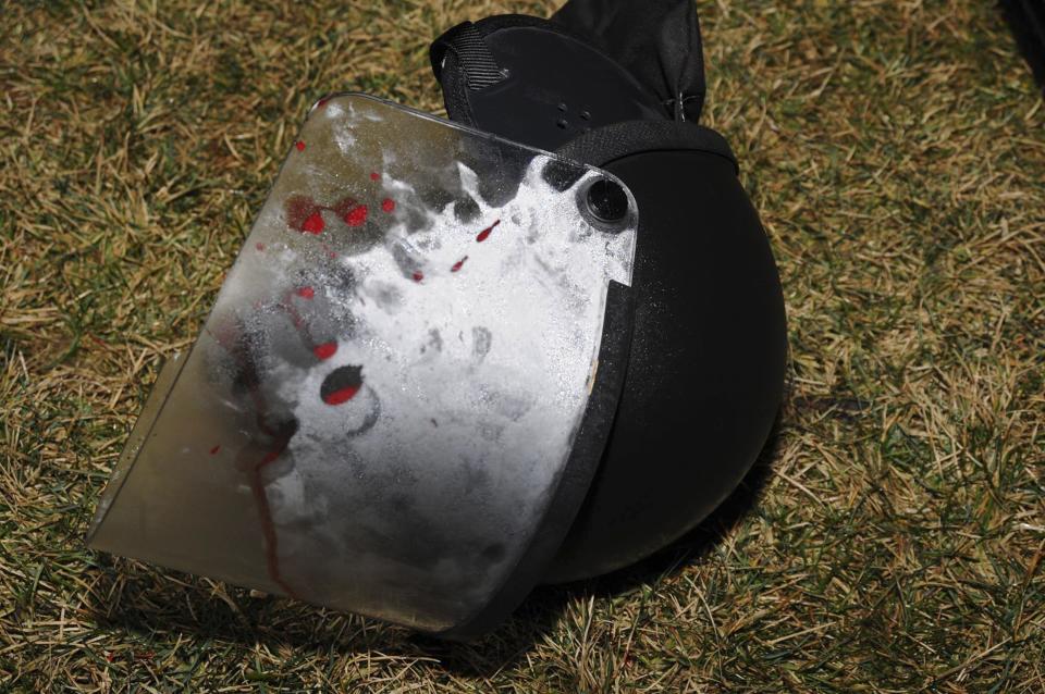 Police said the 32-year-old officer wearing this helmet was shot just below his right eye. (St. Louis Co. Police)