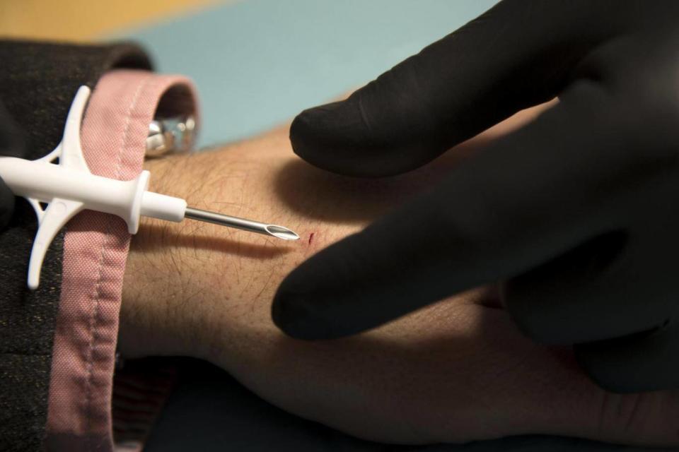 A volunteer getting a chip implanted in his hand (EPA)