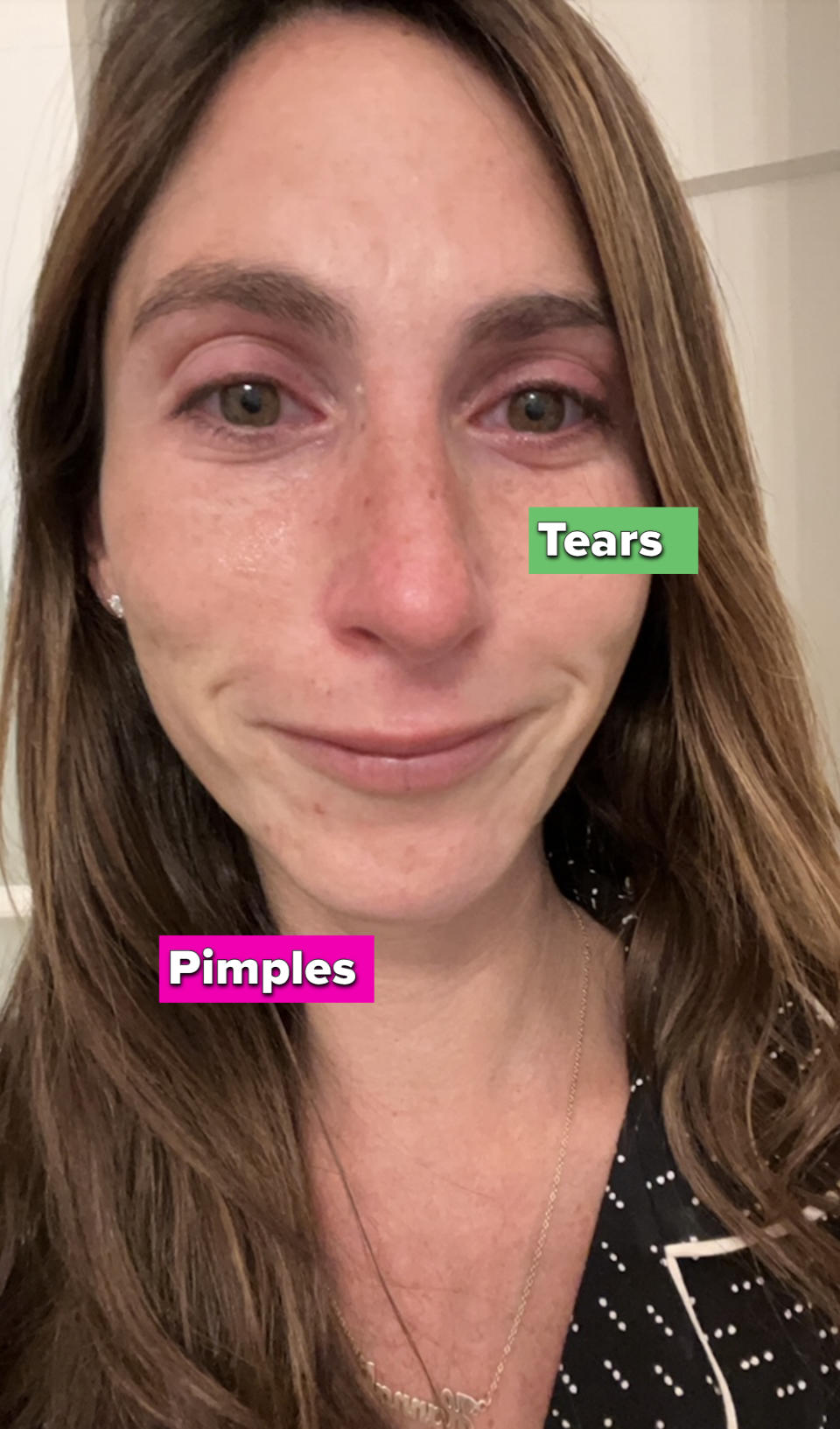 Woman with a tearful expression, close-up selfie, wearing a necklace and polka dot top