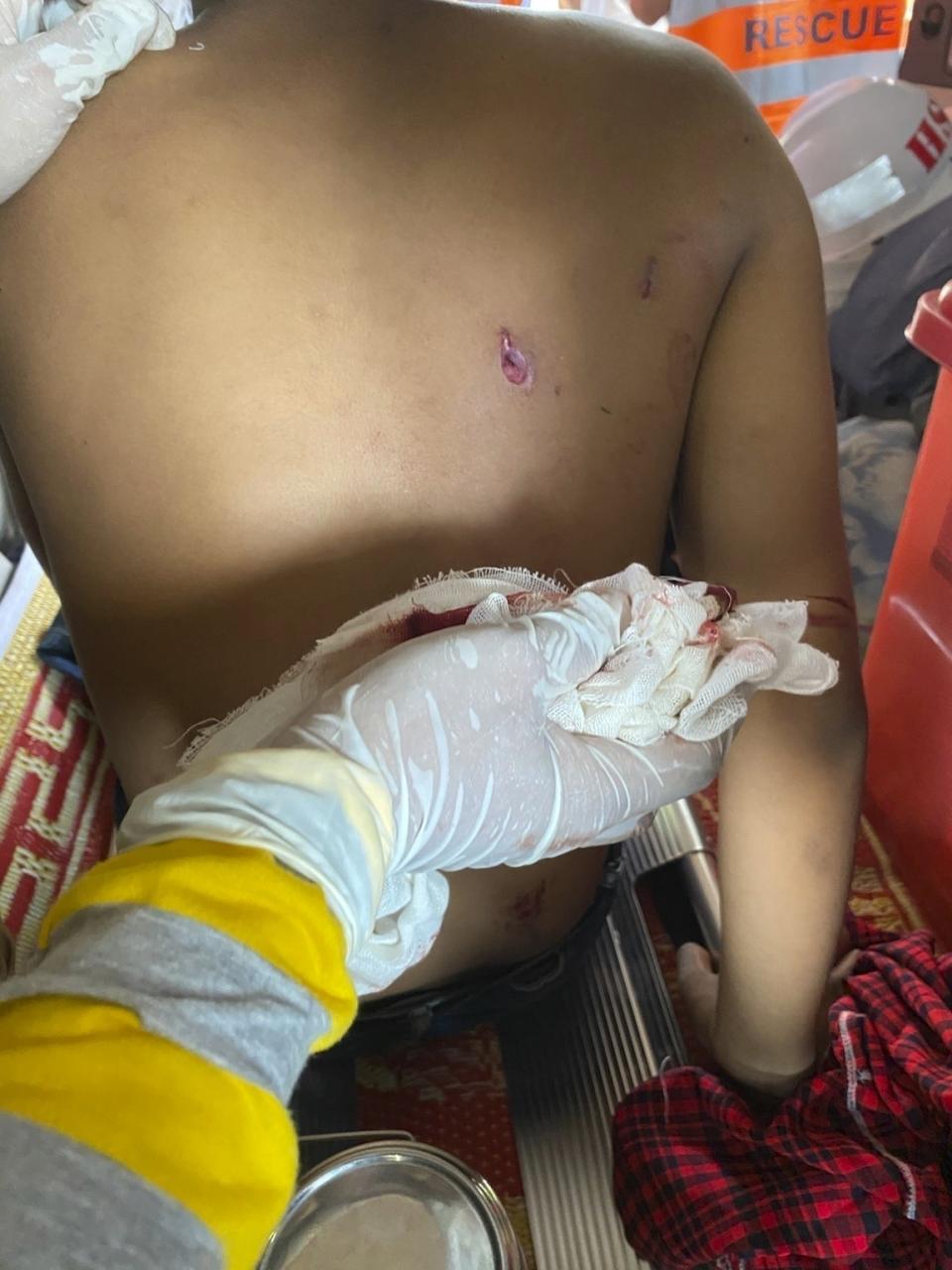 In this March 16, 2021 photo obtained by The Associated Press, Dr. Nay Lin Tun tends to a man wounded in the back by rubber bullets during a protest in Yangon, Myanmar. “In other country’s protests, the medics are safe. They are exempt. Here, there are no exemptions,” says the general practitioner who has been on the run since February, and now provides care covertly. (AP Photo)