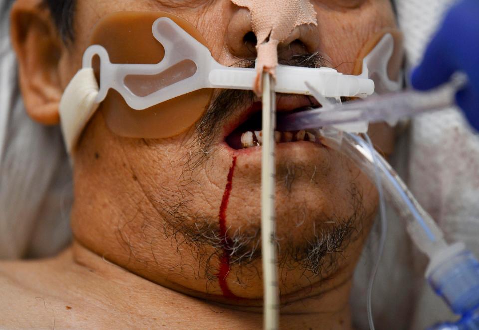 A nurse cleans a patient's mouth in the intensive care unit on Tuesday, Feb. 9, 2021, at Providence Holy Cross Medical Center in Los Angeles. "With COVID cases, some patients are not able to maintain their airways so they have to be intubated in order for them to stay alive," says Nino O, a travel nurse from Long Island, New York.