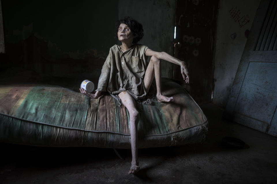 Zaida Bravo, who suffers Parkinson's disease and is malnourished, waits for dinner on her dirty mattress in her one room living quarters in Maracaibo, Venezuela, Nov. 28, 2019. The 48-year-old's sister Ana Bravo brings her food when she can, but for the last four years the older sister has had trouble affording even rice or cornmeal. “We can't find her medicine or even know how to help her, so we're letting what happens happen,” Ana Bravo, 57, said. “Sometimes, I'm afraid to go inside and find her dead.” (AP Photo/Rodrigo Abd)