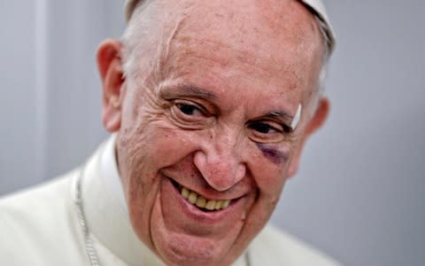 Pope Francis smiles as he talks to journalists on board the flight back to Rome. He was lightly injured when his Popemobile abruptly braked during the visit to Colombia. - Credit: AFP