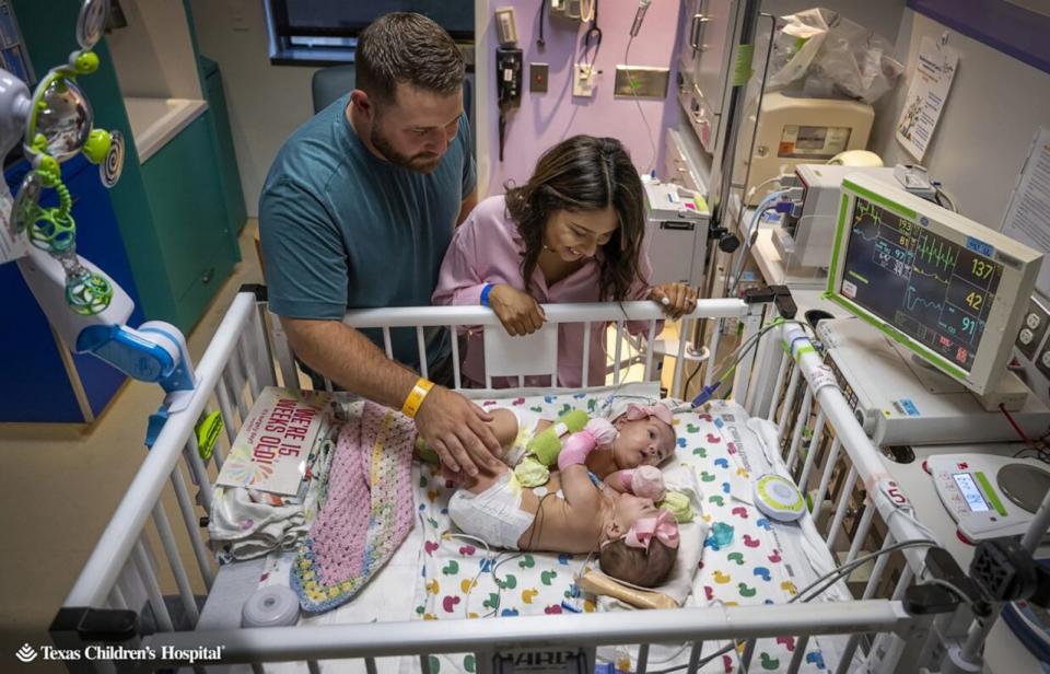 PHOTO: Sandy and Jesse Fuller pose with their twin daughters prior to a separation surgery for the newborns at Texas Children's Hospital. (Texas Children's Hospital)