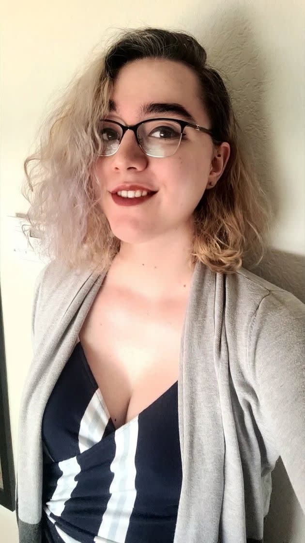 Zoe Tunnell successfully crowd-funded her top surgery and then began her search to find a trans-friendly cosmetic surgeon. (Photo: Zoe Tunnell)