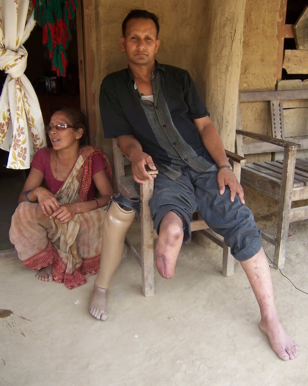 This handout photo shows Nepalese torture victim Ashok Sodari, 35, at his home in Sanoshree, a village in the southern district of Bardiya, in July 2012. His story forms part of "The Resurrected", a chilling new documentary by Kathmandu-based film-maker Ganesh Pandey