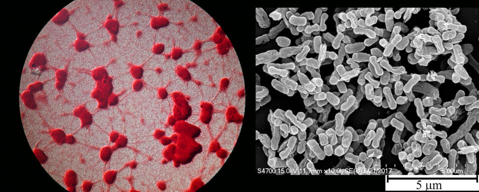 （左圖）細菌形成生物膜在顯微鏡下的樣子。（右圖）鮑氏不動桿菌在掃描式電子顯微鏡下的樣子。