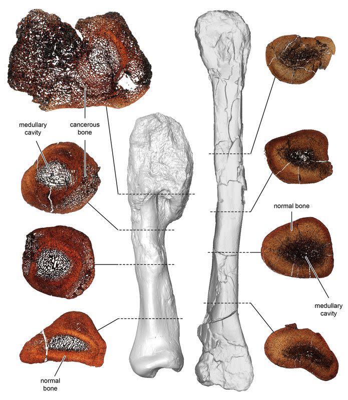 A comparison between thin sections of the cancerous leg bone and normal shin bone of the horned dinosaur Centrosaurus apertus