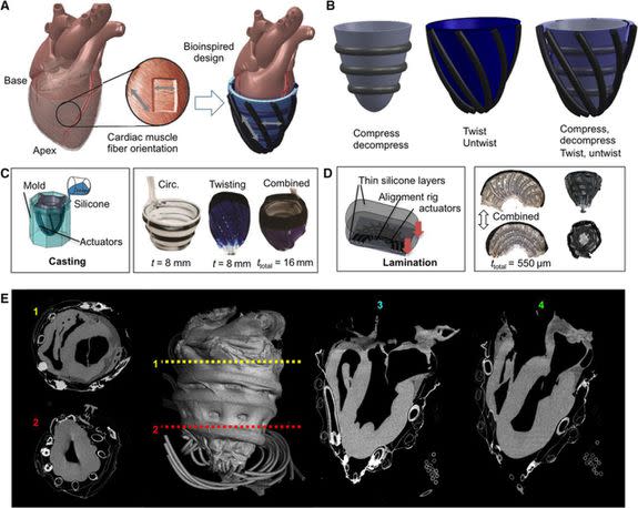 A) How muscle fibers are oriented right outside the heart inspired the design of the VAD. B) The soft fibers of the robotic sleeve can compress and twist along with the motion of the heart. C) Silicone casting was used to produce the new implantable device. D) 3-D printing was also used to construct the implantable robot. E) These are areas of the heart which the robotic sleeve can wrap around.