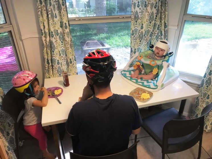 Baby Jonas, who suffers from flat head syndrome, is not alone in his helmet-wearing.