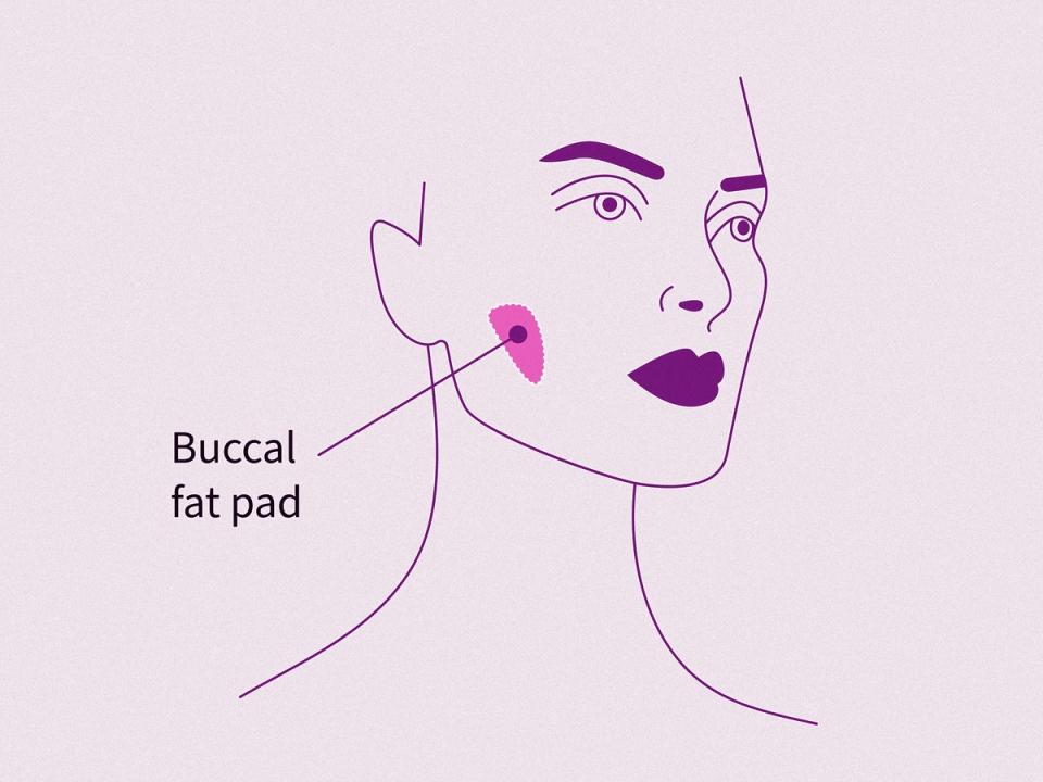 If you must know, your buccal fat pad is located just under your cheek (iStock)