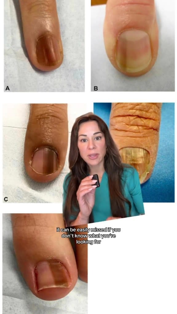 Zubritsky showed examples of nails that should warrant a visit to the doctor. tiktok/@dermguru