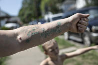 Brittany Cunningham 31, shows off her tattoo which reads, "Love Yourself" on her left forearm in Nelsonville, Ohio, on Friday, July 24, 2020. "Those are to hide the suicide scars," she said. (AP Photo/Wong Maye-E)