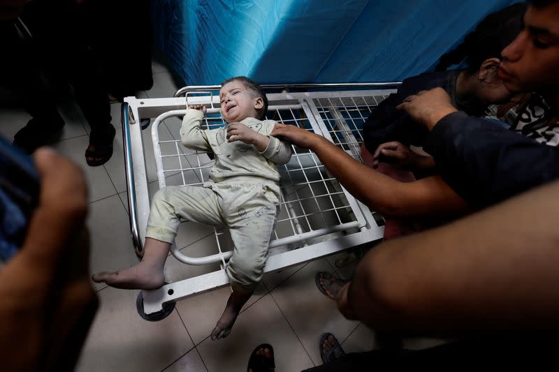 Un niño palestino herido en ataques israelíes espera recibir tratamiento en el hospital Nasser en Khan Younis, en el sur de la Franja de Gaza