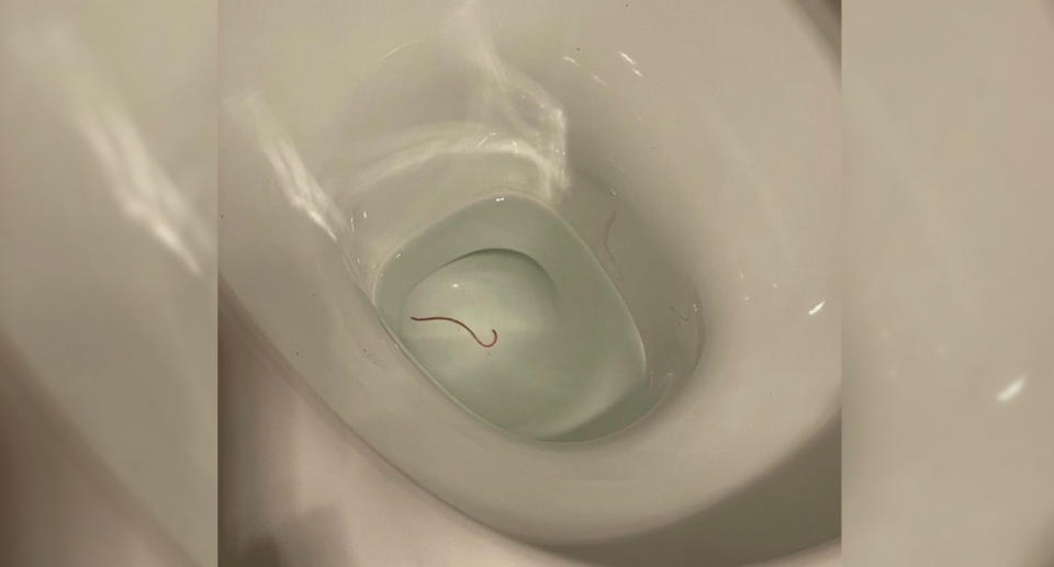 The picture the snake catcher received can be seen: A white toilet basin with a slim long worm at the bottom.