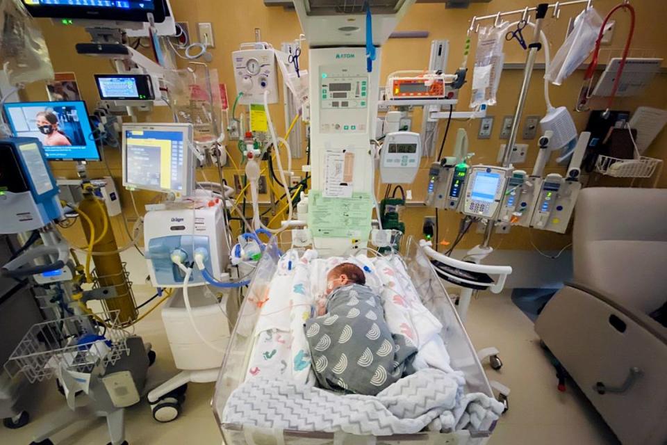 Newly born Oliver Setten lays in a natal intensive care unit room at Seattle Children’s Hospital.