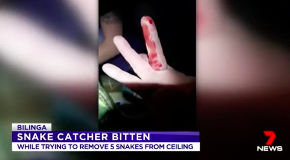 The removal of five carpet pythons took an hour – and drew blood. Source: 7 News