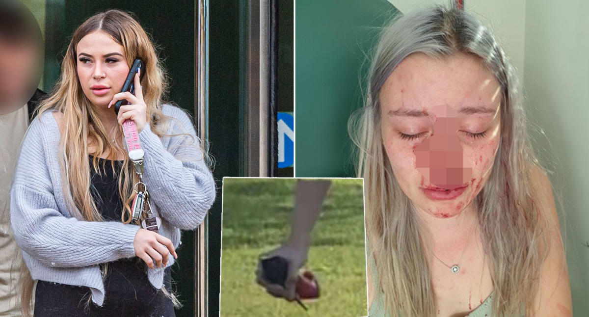 Woman hit boyfriend s ex with stiletto shaped perfume bottle