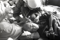 A small atomic bomb survivor receives a treatment at temporary hospital set at Shin Kozen Elementary School on Sept. 23, 1945 in Nagasaki, Japan. (Photo: Yasuo Tomishige/The Asahi Shimbun via Getty Images)