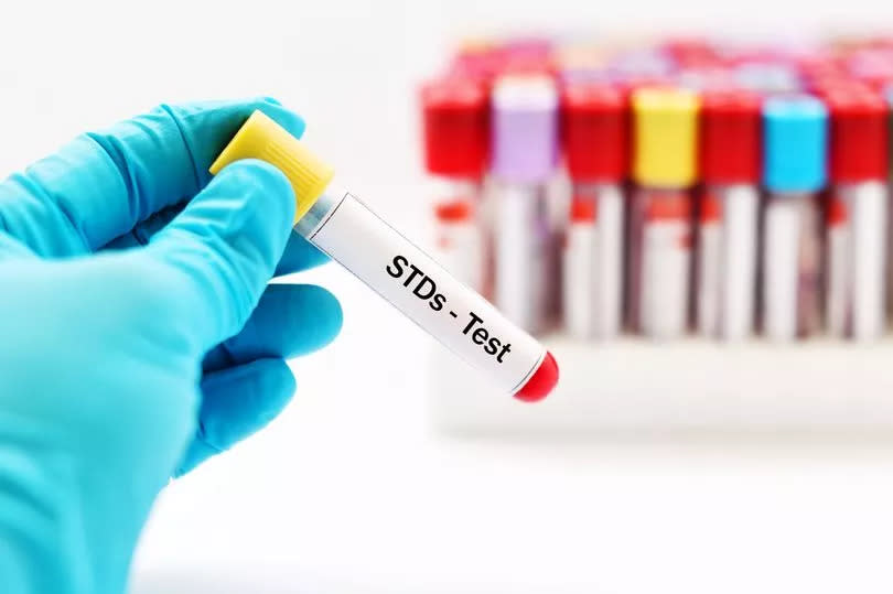 Blood sample for STDs (sexually transmitted diseases) test
