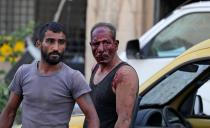 Wounded people walk near the scene of an explosion in Beirut on August 4, 2020. - Two huge explosion rocked the Lebanese capital Beirut, wounding dozens of people, shaking buildings and sending huge plumes of smoke billowing into the sky. Lebanese media carried images of people trapped under rubble, some bloodied, after the massive explosions, the cause of which was not immediately known. (Photo by ANWAR AMRO / AFP) (Photo by ANWAR AMRO/AFP via Getty Images)