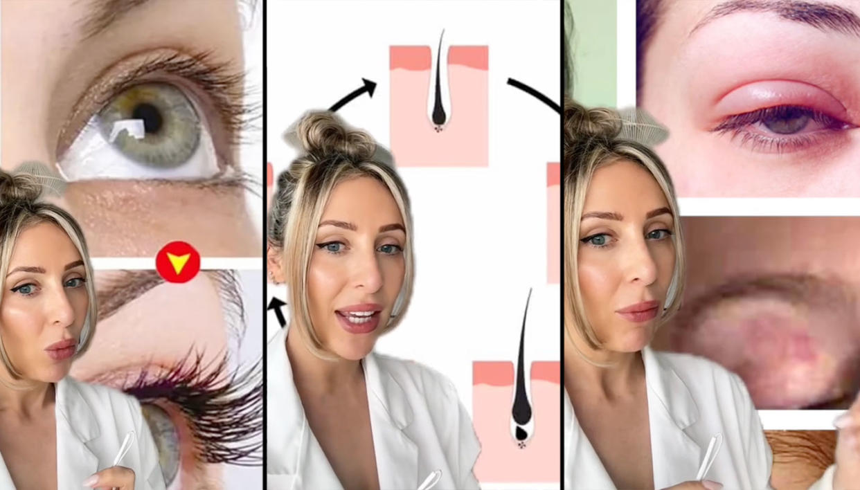 Carly Musleh posted a video highlighting her concerns about eyelash growth serums. (TikTok/carlymusleh)