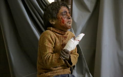 A wounded Syrian child waits to receive medical treatment at a hospital after Assad Regime's attacks over a market place in Eastern Ghouta's Kafr Batna town  - Credit: Getty