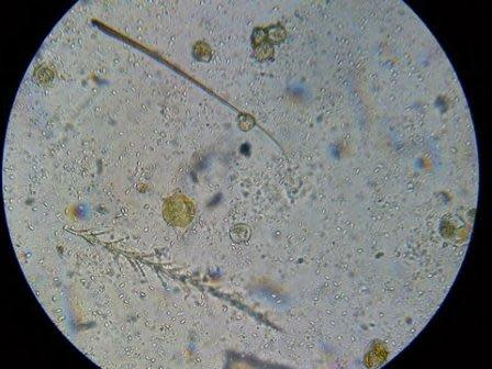 Bee Hairs, Nosema Ceranae Spores (white ovals) and Pollen (larger)