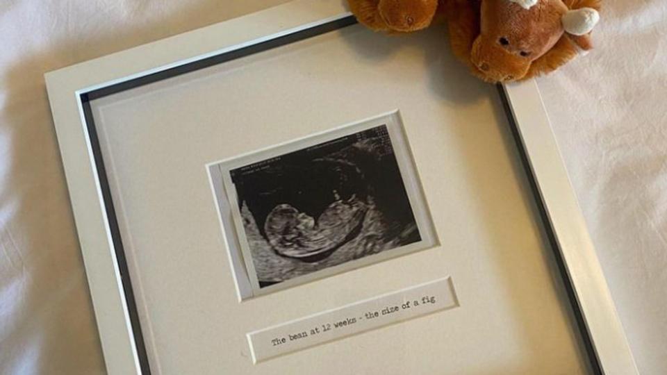 A baby scan in a framed photo with a pair of baby slippers in the shape of brown highland cows