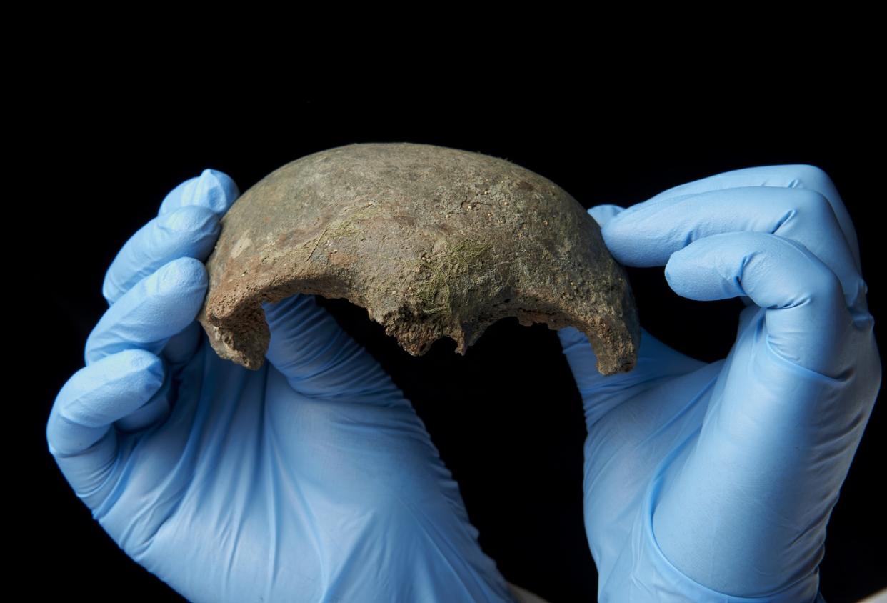 The frontal bone of a skull found on the South Bank of the Thames foreshore in London, it dates back to 3600BC.