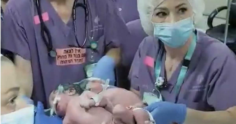 這對雙胞胎自去年8月出生以來，醫療團隊就開始手術的規劃。（圖／翻攝自@SorokaMedicalCenter臉書）
