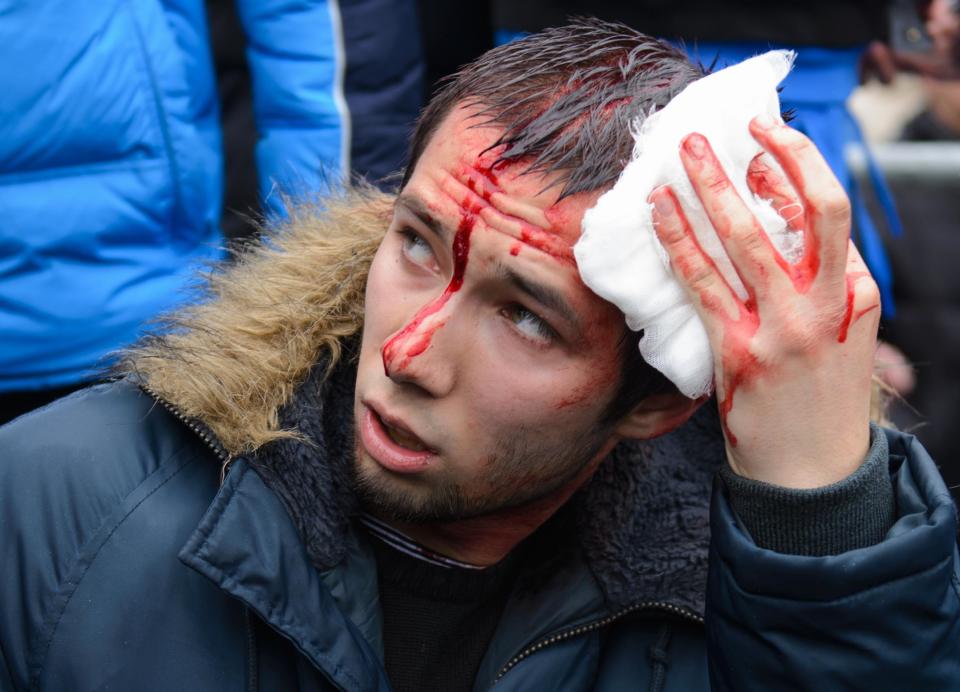 A wounded pro-Western activist sits after clashes with pro-Russia activists at the local administration building in the northeastern city of Kharkiv, Ukraine, Saturday, March 1, 2014. Supporters of new Ukrainian authorities and pro-Russia demonstrators clashed in Kharkiv, a mostly Russian-speaking region in eastern Ukraine. (AP Photo/Olga Ivashchenko)