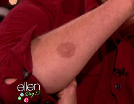 Cooper reveals a 'nipple' on his forearm. Photo: The Ellen DeGeneres Show