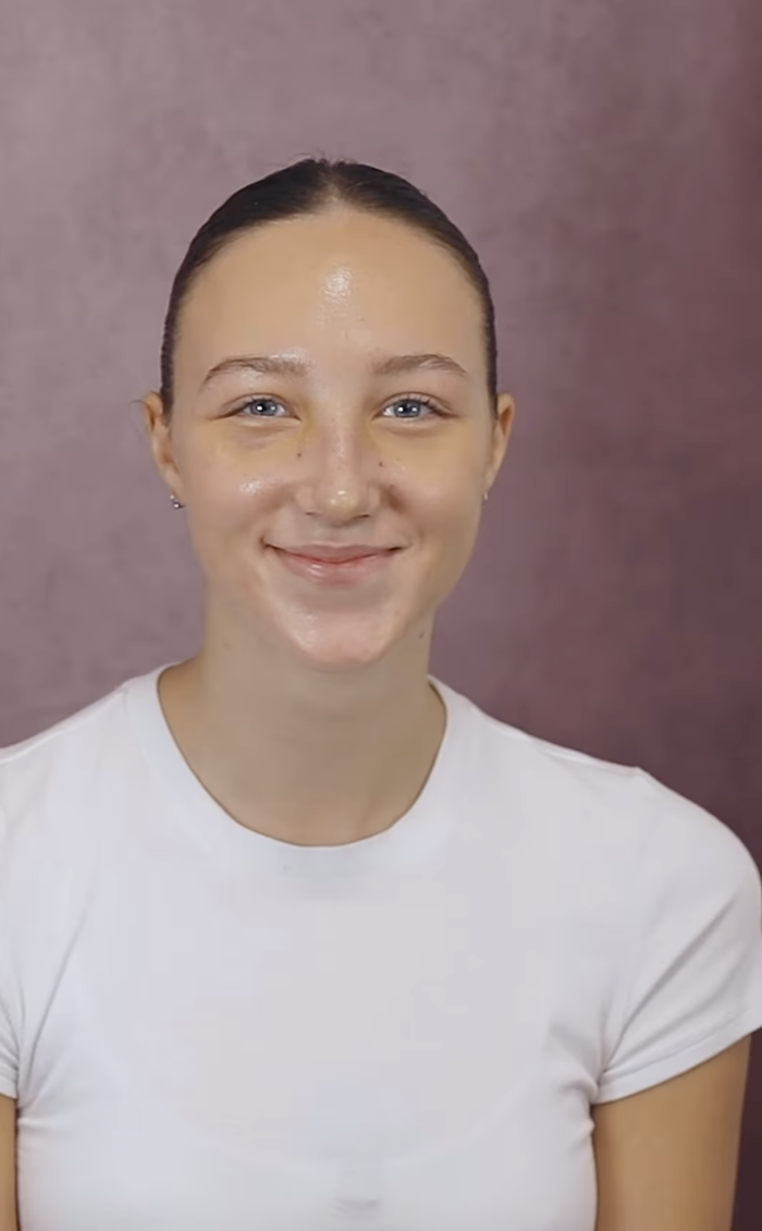 closeup of her smiling with her new nose