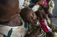 Letmedhin Eyasu holds her one year-old son Zewila Gebru, who is suffering from malnutrition at a health center in Agbe, Ethiopia Monday, June 7, 2021. For months, the United Nations has warned of famine in Tigray and now internal documents and witness accounts reveal the first starvation deaths since Ethiopia's government in June imposed what the U.N. calls "a de facto humanitarian aid blockade." (Mulugeta Ayene/UNICEF via AP)