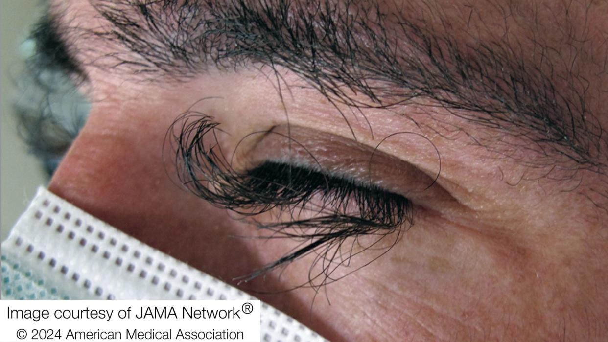  Close up of a man's closed eye, showing his very, very long, dark and curly eyelashes. 